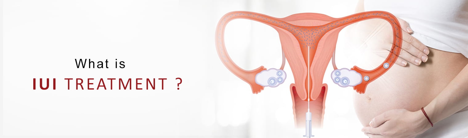 Intrauterine Insemination (IUI)